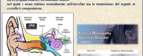 Neuropatia uditiva